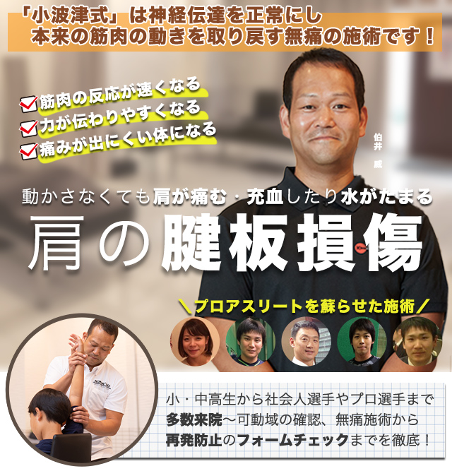 腱板損傷